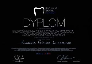 Exclusive Dental Bezpośrednia odbudowa za pomocą licówek kompozytowych Klaudia Górska - LitaszewskaLekarz Stomatolog - Klaudia Gorska