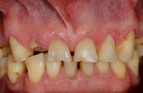 Metamorfozy zębówPiękny uśmiech w Zamościu