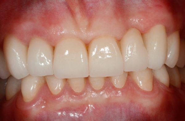 Metamorfozy zębówPiękny uśmiech w Zamościu
