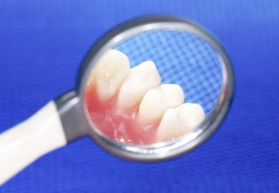 Komórki macierzyste można uzyskać także z miazgi zębów