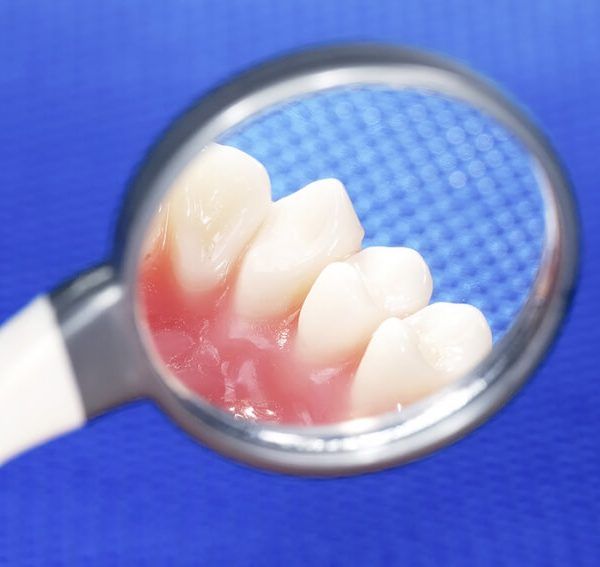 Komórki macierzyste można uzyskać także z miazgi zębów